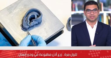 تفاصيل زراعة أول أذن مطبوعة فى وجه إنسان.. فيديو