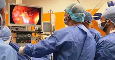 إجراء جراحة "ويبل" بالمنظار الجراحي لأول مرة بمركز علاج الأورام فى دمنهور