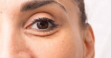 وصفات طبيعية لعلاج تجاعيد تحت العين.. للحصول على بشرة ناعمة وشابة