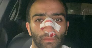 عموري يجرى أشعة مقطعية بعد تعرضه لنزيف بالأنف في مباراة المصري والجونة