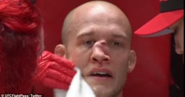 إصابة لاعب فنون قتالية مختلطة "MMA" بأسوأ أنف مكسور على الإطلاق.. صور