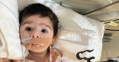 السعودية نيوز | 
                                            وزارة الصحة تستقبل الطفل "سليم" من السعودية بمستشفى الطفل 
                                        