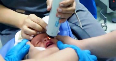 تشغيل أحدث جهاز لتصوير قاع العين وفحص الشبكية للأطفال بمستشفى سوهاج التعليمي