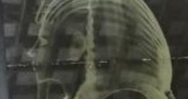 سفارة إيطاليا تهدى مكتبة الإسكندرية أول أشعة سينية لقناع توت عنخ آمون.. صور