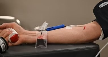 منتج جديد لنقل الدم يجمع بين الدم والبلازما في كيس واحد.. اعرف التفاصيل