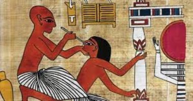 التخدير.. هل عرفه القدماء المصريون في ممارساتهم الطبية؟