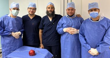 استخراج فوطة جراحية مهملة منذ 7 أعوام من بطن مريض بالمنوفية