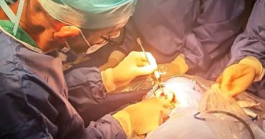 إجراء 6 عمليات زراعة قوقعة للأطفال بمستشفى الهلال بسوهاج خلال 24 ساعة