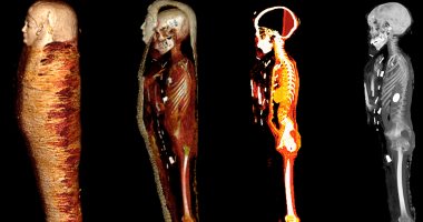 الأشعة المقطعية تكشف أسرار مومياء الصبى الذهبى ببدروم المتحف المصرى بالتحرير