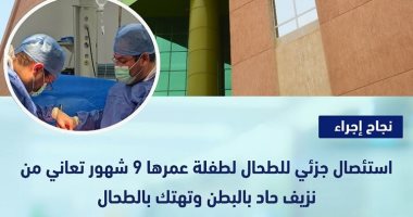 أطباء مستشفى طيبة ينجحون فى استئصال جزئى لطحال طفلة 9 شهور.. التفاصيل