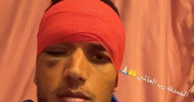 غنام محمد يكشف حجم إصابته فى الرأس بعد مواجهة بيراميدز