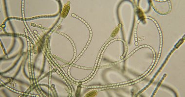 اكتشاف بكتيريا غريبة تساعد على استخراج عناصر أرضية نادرة من مياه الصرف