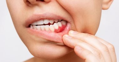 ديلى ميل: تنظيف الأسنان بشكل صحيح يقلل من الإصابة بالتهاب المفاصل