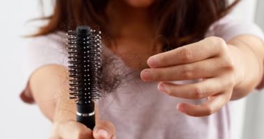 هل يمكن أن يؤثر "الدايت" بالسلب على صحة الشعر؟ اعرفى أبرز الأخطاء