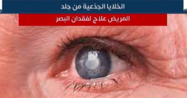 علاج لفقدان البصر من الخلايا الجذعية بجلد المريض