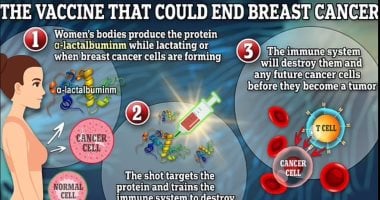 ثورة لمواجهة سرطان الثدى.. لقاح تجريبى يمكنه القضاء على المرض بحلول 2030