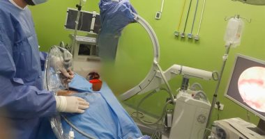 مستشفى منشية البكري العام ينجح في إجراء جراحة دقيقة بالعمود الفقري