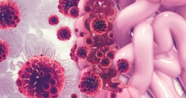 اكتشاف تريليونات من البكتيريا والفيروسات بالأمعاء الغليظة تحمى من السرطان