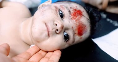  إحصاء: 65% من شهداء العدوان الإسرائيلي على قطاع غزة أطفال ونساء