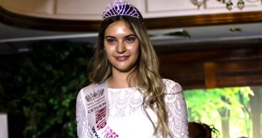 أول ملكة جمال في العالم بدون مكياج تتنازل عن لقبها لتحضر حفل زفاف صديقتها