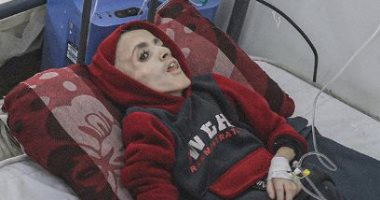 الطفل يزن يتحول لهيكل عظمى قبل وفاته جوعا.. حرب التجويع فى غزة.. فيديو