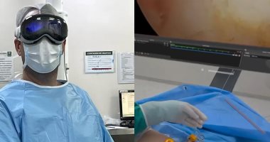 طبيب يستخدام نظارة Apple Vision Pro خلال إجراء جراحة في البرازيل