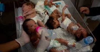 ممثل الصحة العالمية فى فلسطين: 16.5% من أطفال غزة يعانون سوء التغذية بعد الحرب