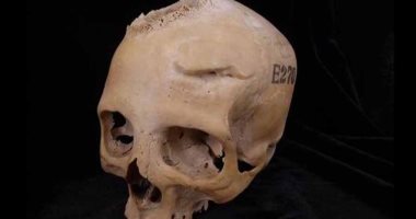 دراسة حديثة: المصريون القدماء حاولوا علاج سرطان الدماغ