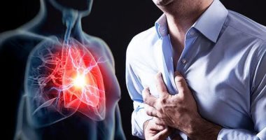 أستاذ جراحة قلب يوضح الفرق بين أعراض انسداد الشرايين وارتجاع المرىء