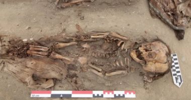 العثور على هياكل عظمية لأطفال الإنكا مدفونة منذ 500 عام مشوهة بفيروس الجدري