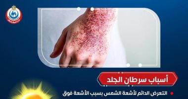 وزارة الصحة تكشف أسباب الإصابة بسرطان الجلد.. إنفوجراف