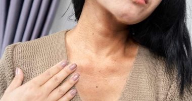 3 وصفات طبيعية فعالة للتخلص من اسمرار الرقبة 