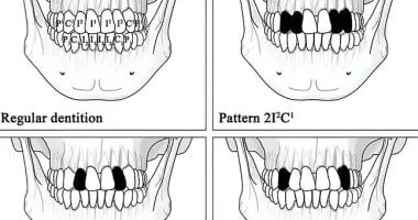 دراسة تكشف إجراء عمليات التجميل منذ 4800 عام فى تايوان