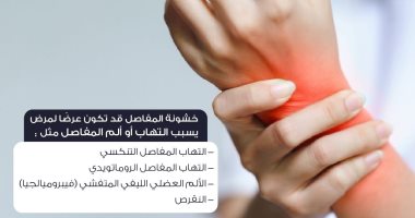 هيئة الدواء تكشف معلومات مهمة عن إصابات خشونة المفاصل.. إنفوجراف 