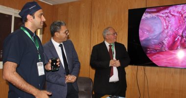 مستشفيات جامعة أسوان تنظم ورشة عن الحالات المتقدمة فى جراحة المناظير.. صور