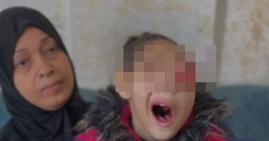 "لا تستطيع الأكل بفمها ولا ترى بعينها".. هناء العوضى طفلة فلسطينية حياتها مهددة بالخطر فى غزة.. ولدت بحجم رأس صغير وتعانى من ضمور.. أصيبت بالسرطان منذ 4 أشهر.. الأطباء لم يجدوا علاج لها وتعيش على المسكنات.. صور
