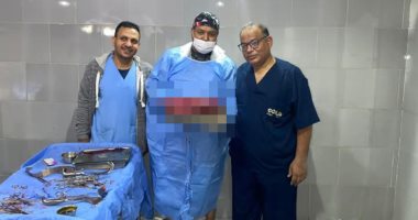 جراحة نادرة بقنا العام.. استئصال ورم ضخم من مبيض سيدة حامل بالشهر التاسع