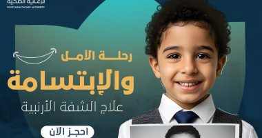 تضم خبراء أجانب.. قافلة طبية لعلاج الشفة الأرنبية الأسبوع الجارى بالأقصر