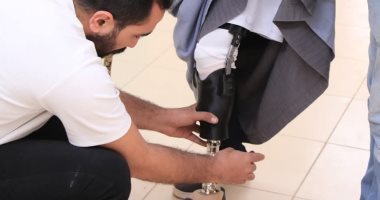 مؤسسة الجارحى عضو التحالف الوطنى تطلق مبادرة لدعم ذوى الهمم بالأطراف الصناعية