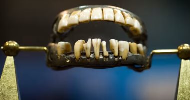 أطقم الأسنان ظهرت فى العصور القديمة.. اعرف حكايتها ولماذا استخدمت؟ 