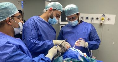 مستشفى سوهاج الجامعى تنقذ حياة سيدة مصابة بضربة "فأس" فى الرأس