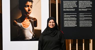 فلسطينية تفوز بجائزة الصحافة العالمية عن صورة طفل شوهته غارة إسرائيلية الصورة الفائزة والصحفية الفلسطينية