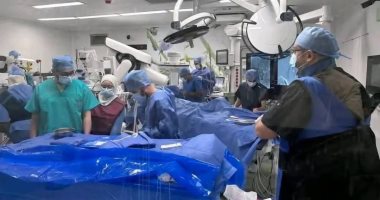 عميد طب قصر العينى: عملية استئصال جهاز منظم ضربات القلب المصاب وملحقاته نادرة عملية استئصال جهاز منظم ضربات القلب