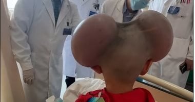 نيوز برو : 
                                            تعرض للتنمر ولقب بـ ميكى ماوس.. قصة طفل واجه حالته النادرة بشجاعة
                                        