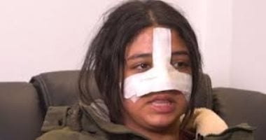 نيابة الطفل تستكمل التحقيقات فى قضية الطالبة كارما بعد ورود تقرير الطب الشرعي الطالبة كارما ضحية الاعتداء من قبل زميلتها