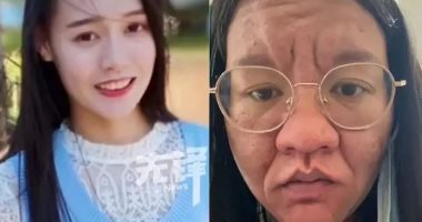 ماعرفتش نفسها فى المراية.. الحمل يتسبب فى تحول جسدي مذهل لسيدة صينية تحولات السيدة الصينية