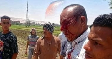 التقرير الطبى للموظف المعتدى عليه بسوهاج: انفجار مفرغ فى مقلة العين اليسرى الموظف المعتدى عليه فى سوهاج