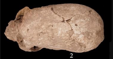 لغز العثور على جمجمة مخروطية الرأس عمرها 6200 عام في إيران جمجمة مخروطية الرأس