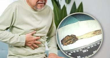 رجل صيني 64 عامًا يكتشف فرشاة أسنان عالقة في أمعائه ابتلعها في عمر 12 سنة