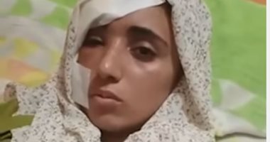 ناجية من حادث إقليمى المنوفية: 4 من ولاد عمتى كانوا معايا فى العربية
